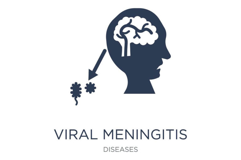 Viral Meningitis Pediatric Associates Of Charlottesville